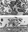 micrograph_mynox_small.jpg