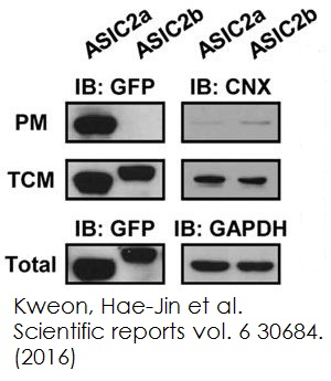 ab65400-337245-plasma-membrane-protein-extraction-kit.jpg